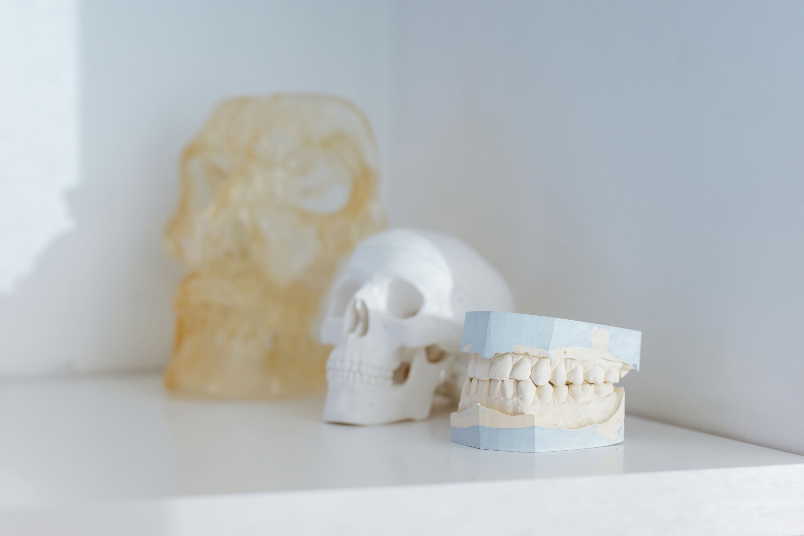Crânes et prothèses moulées sur une surface blanche, liés aux dispositifs médicaux d'impression 3D. MedAdd